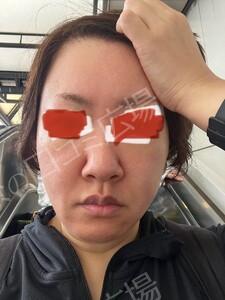 治療結果の症例写真