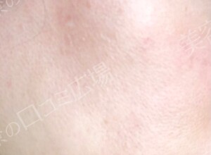 治療結果の症例写真
