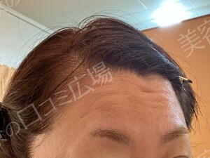 治療前の症例写真