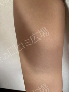 治療結果の症例写真