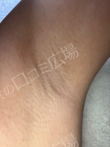 治療前の症例写真