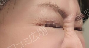 治療結果の症例写真