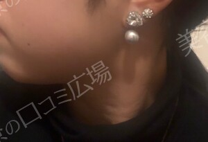 治療結果の症例写真