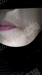 治療結果の症例写真
