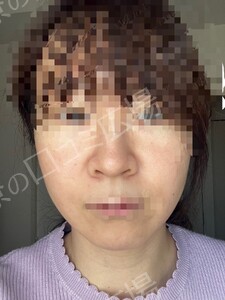 治療結果の症例写真