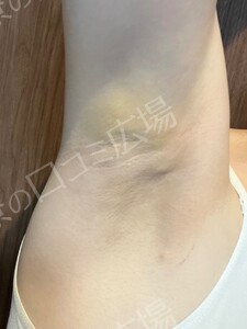 治療結果の症例写真