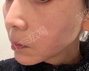 治療結果の症例写真