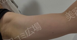 治療結果の症例写真