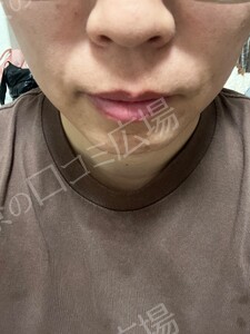 治療前の症例写真