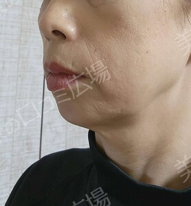 治療前の症例写真
