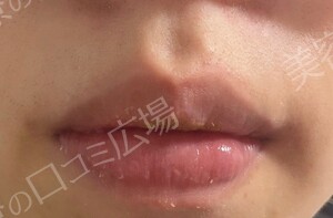 治療結果の症例写真