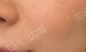 治療結果の症例写真