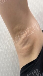 治療結果の症例写真
