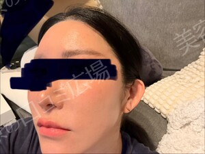 医療法人秀晄会 心斎橋コムロ美容外科クリニックの症例写真[アフター]