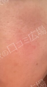 治療結果の症例写真
