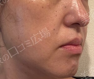 治療前の症例写真