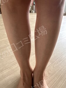 治療前の症例写真