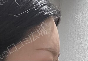 治療結果の症例写真
