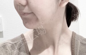 治療前の症例写真