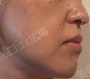 治療結果の症例写真