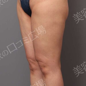 治療結果の症例写真