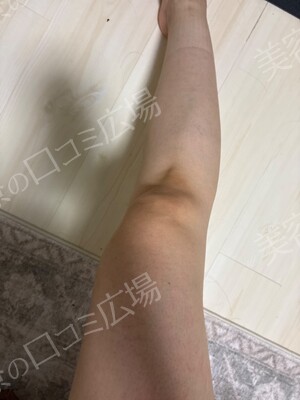椿クリニックの症例写真[アフター]