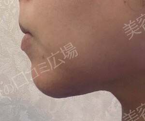 治療結果の症例写真