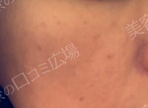 治療前の症例写真