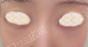治療前の症例写真