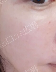 治療結果の症例写真