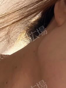 治療前の症例写真