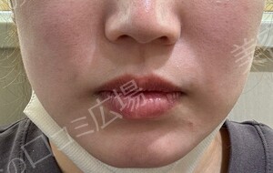 治療前の症例写真