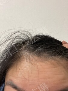 治療前の症例写真
