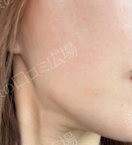 治療結果の症例写真