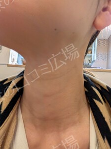 治療結果の症例写真