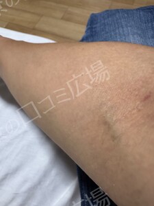 治療前の症例写真