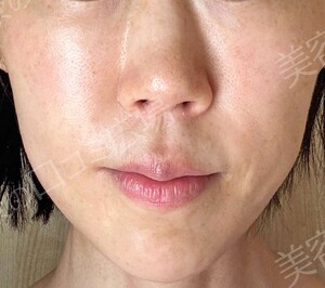 治療結果の症例写真