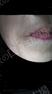 治療結果の症例写真