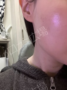 治療結果の症例写真