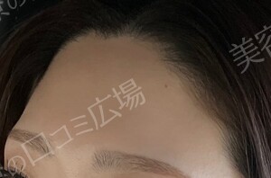治療前の症例写真