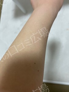 治療結果の症例写真