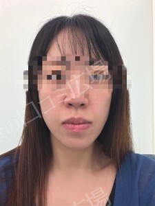 治療前の症例写真