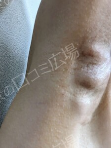 治療結果の症例写真