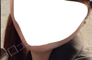 治療結果の症例写真