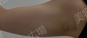 治療結果の症例写真