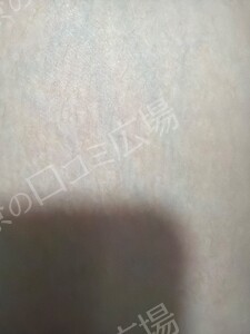 治療結果の症例写真