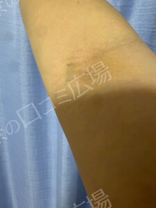 治療結果の症例写真