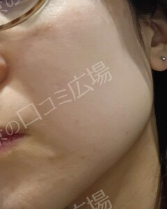 治療前の症例写真