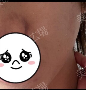 治療前の症例写真