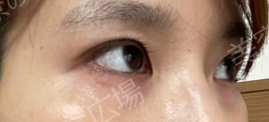 治療前の症例写真